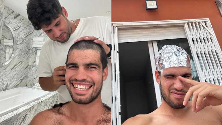 The world No. 1 shared photos of his hair journey, from Alvaro’s infamous slip-up to the foils ahead of his platinum look.